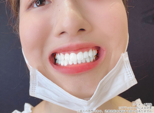 onna